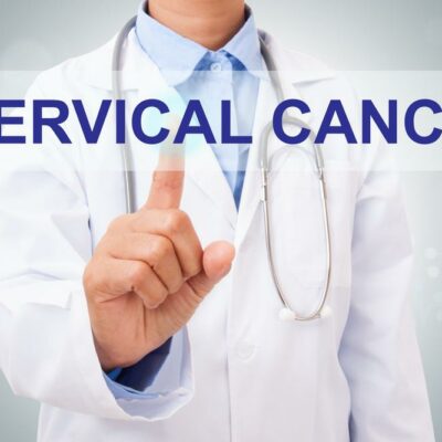 Everything you need to know about the diagnosis and staging of cervical cancer