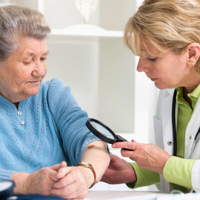 Early Warning Signs of Melanoma